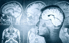 Brain surgery and neurostimulation