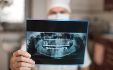 Dental imaging and xray machines
