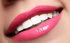 Dental products and whitening services