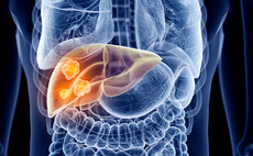 Liver disease treatments and surgery