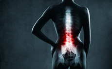 Technology to alleviate spinal injuries